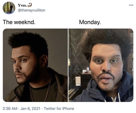 Monday | The Weeknd's Plastic Surgery Face | Know Your Meme