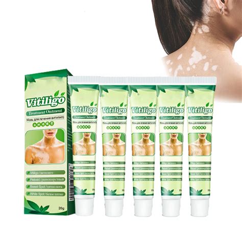 Buy White Tag Moisturizing Cream,White Spot Disease Ointment,Vitiligo ...