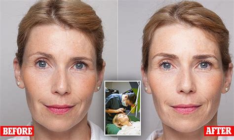 Uneven Eyebrows Causes _ How to Fix Uneven Brows - BYTKCK