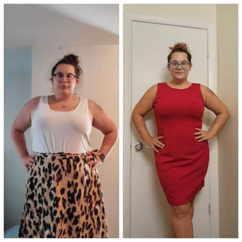 F/28/5'8 [270 lbs-213 lbs= 57lbs] (11 months) Face profile progress ...