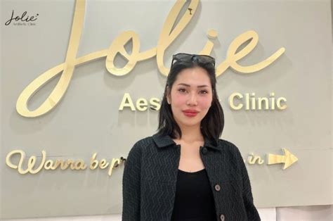 Option Oracle 的图像结果