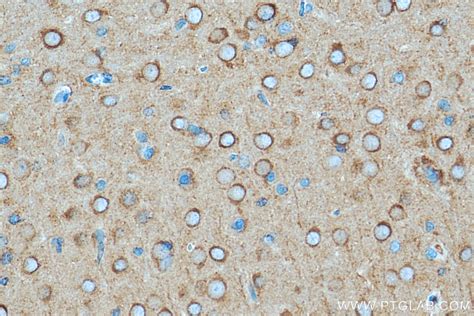 DNM1 antibody (68009-1-Ig) | Proteintech