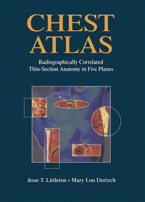 Buy Chest Atlas: Radiographically Correlated Thin-Section Anatomy in ...