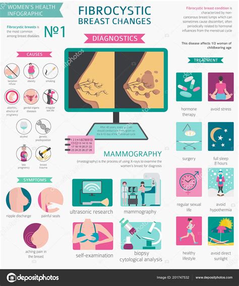 Alterações Mama Fibrocística Doença Infográfico Médico Diagnósticos Sintomas Tratamento Conjunto ...
