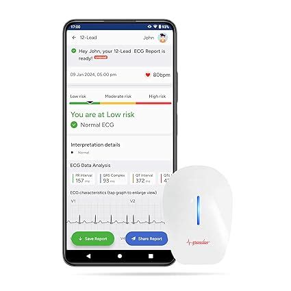 Sunfox Spandan ECG 4.0 with Extra Pack of 100 electrodes | Portable ECG ...