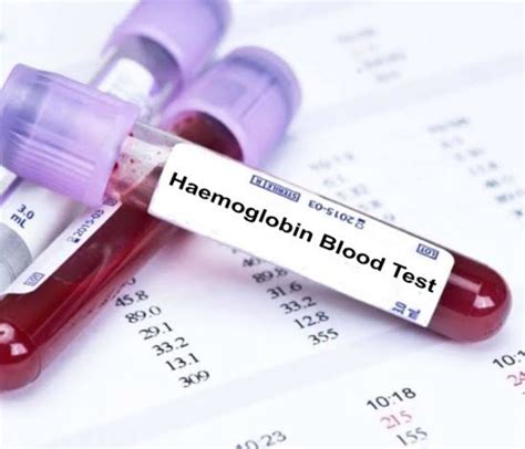 What is a hemoglobin test? @ www.diagnosticcentrepune.in A hemoglobin ...
