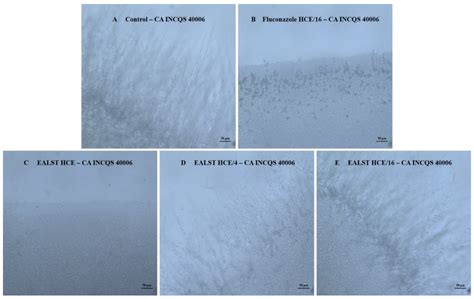 UPLC-MS-ESI-QTOF Analysis and Antifungal Activity of Aqueous Extracts ...