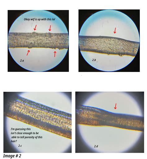 Unhealthy Hair Under Microscope Looking At Damaged Hair Under A