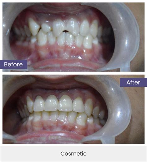 Welcome To Maitri Dental Clinic