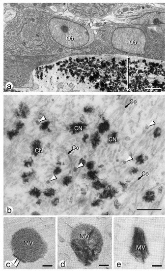 Matrix Vesicle-Mediated Mineralization and Osteocytic Regulation of ...