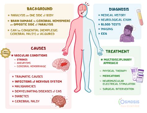 Hemiplegia Causes, Symptoms & Treatments