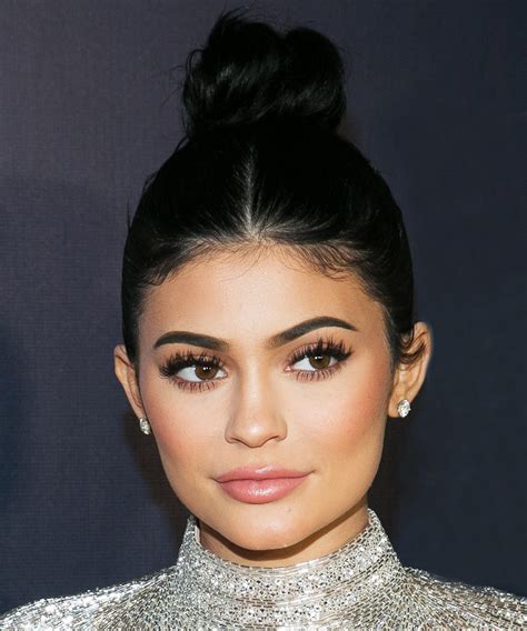 Celebrities With Cleft Lip And Palate