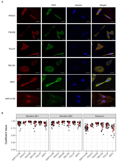 Functional Linkage of RKIP to the Epithelial to Mesenchymal Transition ...