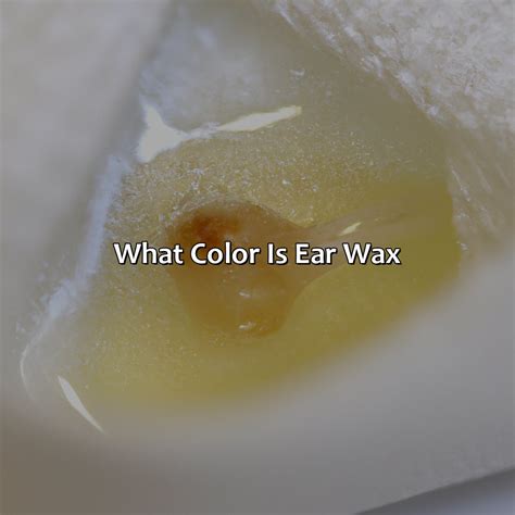 Ear Wax Genetics at Elvira Pierce blog