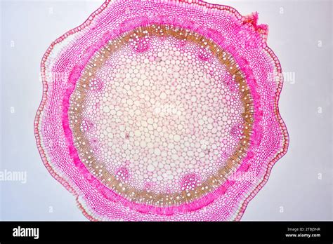 Eudicot young stem of Tilia sp. showing cuticle, epidermis, collenchyma ...
