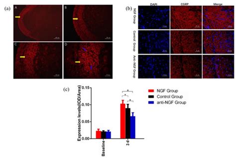NGF-Induced Upregulation of CGRP in Orofacial Pain Induced by Tooth ...
