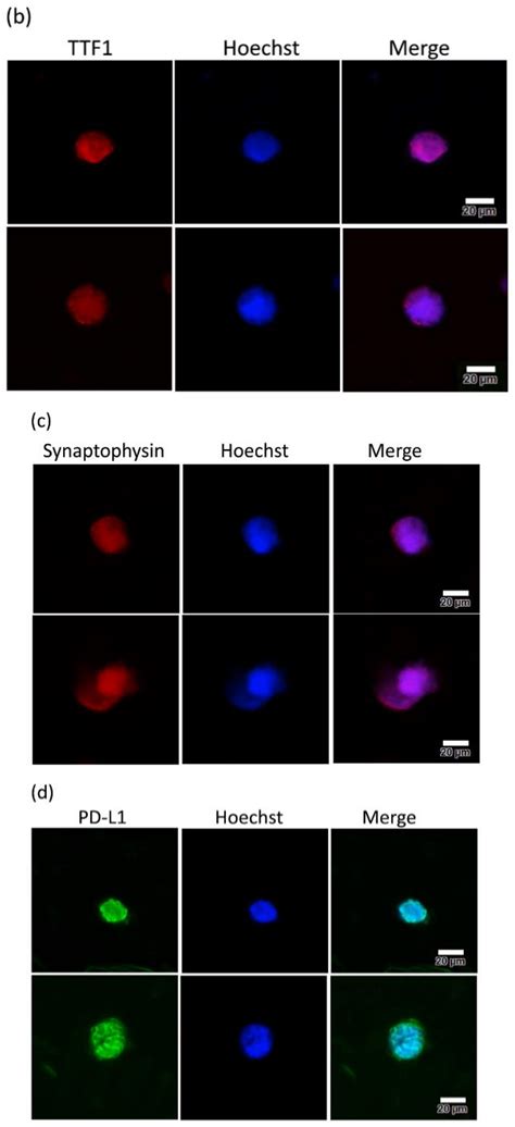 Ex Vivo Expansion and Drug Sensitivity Profiling of Circulating Tumor ...
