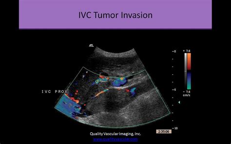 Abdominal Ultrasound Registry Review