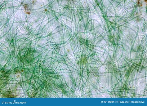 Anabaena is a Genus of Filamentous Cyanobacteria. Stock Photo - Image ...