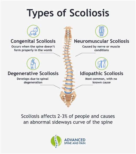 Scoliosis: What is it and How To Treat it | Advanced Spine and Pain