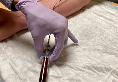 Can Cancer Blood Tests Live up to Promise of Saving Lives? | NewsClick