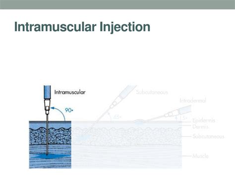 Injection 的图像结果