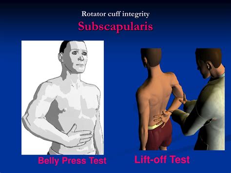 PPT - Shoulder physical examination PowerPoint Presentation, free ...