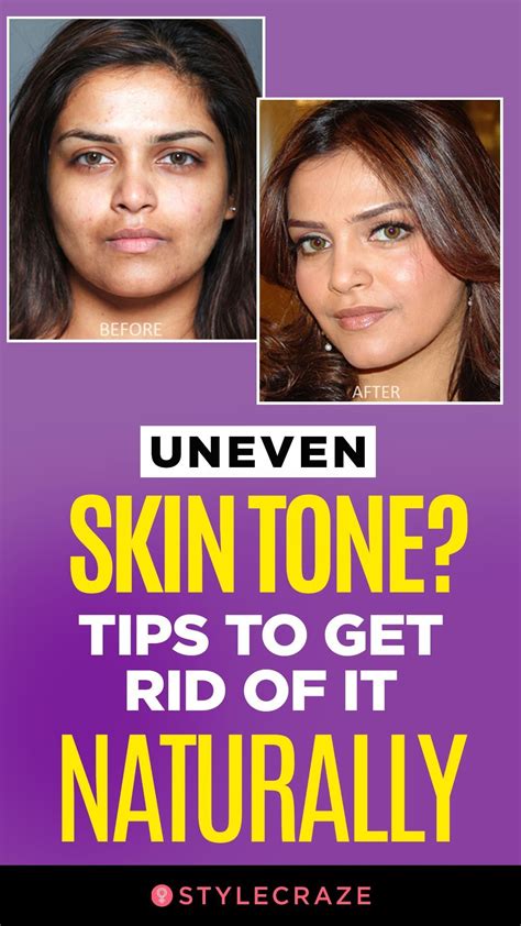 How to fix uneven skin tone treatments remedies and tips – Artofit
