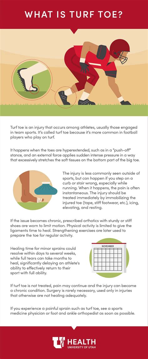 What Is Turf Toe? | University of Utah Health
