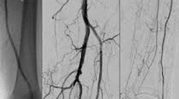 Best Heart Surgeon in Assam - Dr. Intekhab Alam