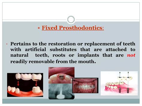 Terminology and classification of fixed prosthodontics | PDF