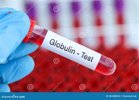Globulin Test To Look for Abnormalities from Blood Stock Photo - Image ...