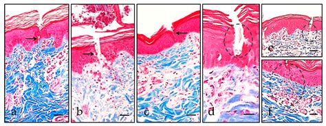 Transdermal Drug Delivery in the Pig Skin