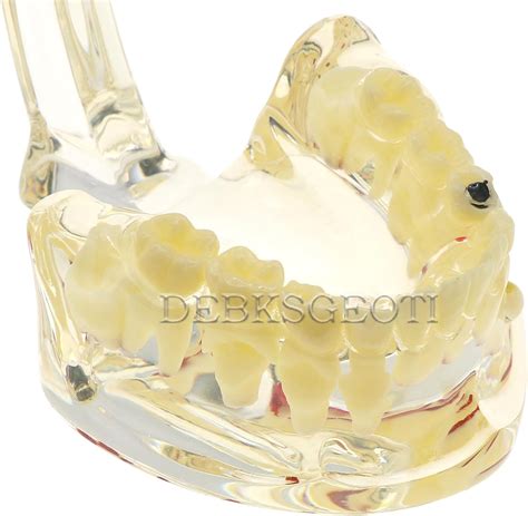 DEBKSGEOTI Dental Kids Typodont Pediatric Model Teeth with India | Ubuy