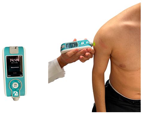Normative Data of Neuromuscular Function in Upper Limb and Its ...