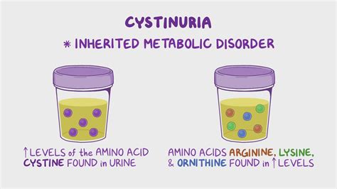 Cystinuria (NORD): Video, Anatomy & Definition | Osmosis