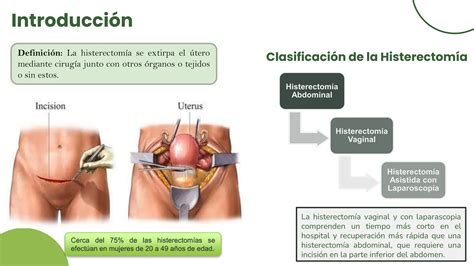 Histerectomia Radical.pptx