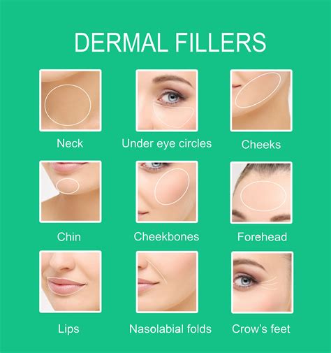 Dermal Fillers Forehead 的图像结果