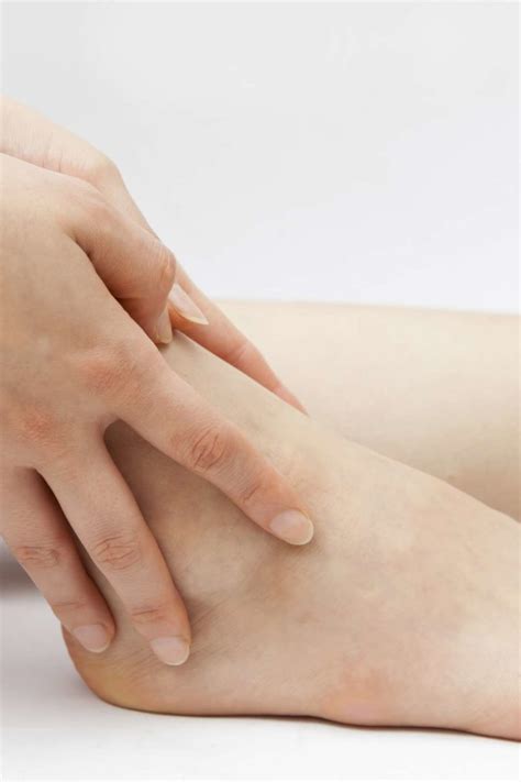 Itchy ankles: Causes, rash, and treatment