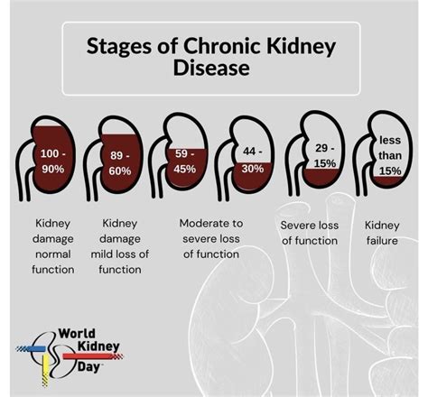 Best 12 10 Signs Your Kidneys Demand Attention – Artofit