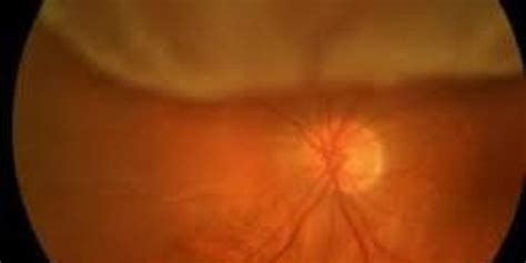 shivam eye clinic