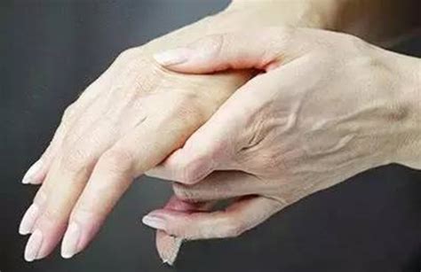 反复出现手指发麻的情况，或与这5种疾病因素有关，要对症治疗|手指|部位|疾病_新浪新闻