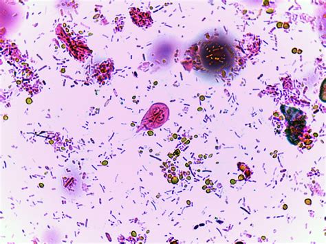Giardia In Dogs Common