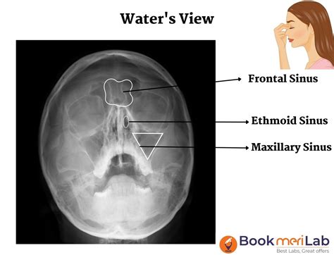 Waters View X Ray Anatomy at Richard Heffner blog