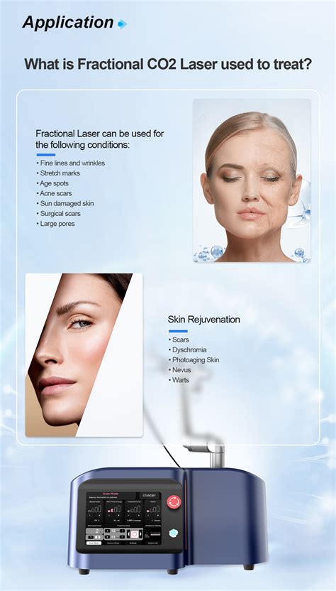 The Advantages Of Treating Scars And Acne With a Portable Co2 Fractional Laser Machine - SANHE LASER