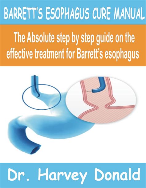 BARRETT’S ESOPHAGUS CURE MANUAL: The Absolute Step by step guide on the effective treatment for ...