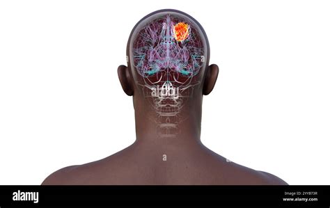 Computer Vision for Tumour 的图像结果