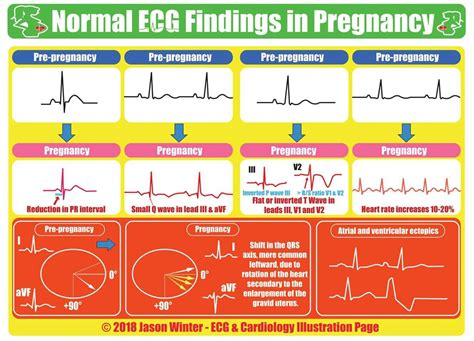 Image result for PR Interval Normal Range