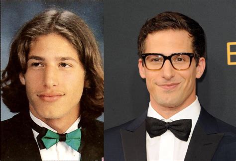 Dentes De Andy Samberg Consertados Andy Samberg Foto Flipado Sobre