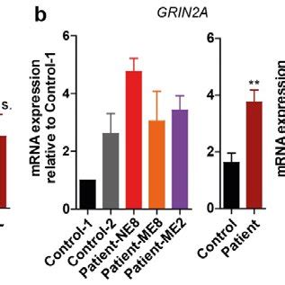 Kuvatulokset haulle brunner syndrome